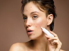 Ways To Keep Your Skin Free Of Acne Acne
