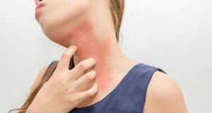 Oh Canada! Dealing with Warm Weather Allergies Allergies