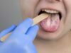 How to get rid of yeast infections? yeast infections