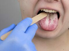 How to get rid of yeast infections? yeast infections