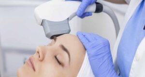 Know about the IPL Treatment IPL Treatment