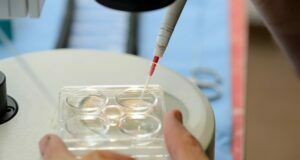 What Makes You Need An Embryo Transfer? Embryo Transfer