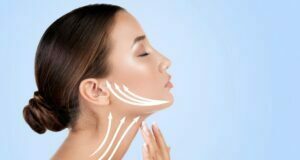 The 5 Facelift Must-Known Facts Facelift