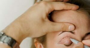 How Do I Know If I Require Blepharoplasty? Blepharoplasty