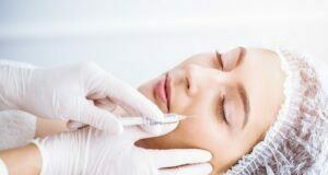 Everything You Need To Know About The Smile Line Fillers Smile Line Fillers