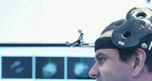 Treating Depression Using Transcranial Magnetic Stimulation Transcranial Magnetic Stimulation